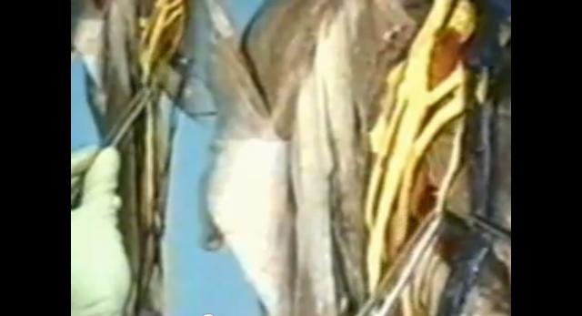 videos de diseccion de anatomia humana en español completo videos de diseccion de anatomia humana en español completo